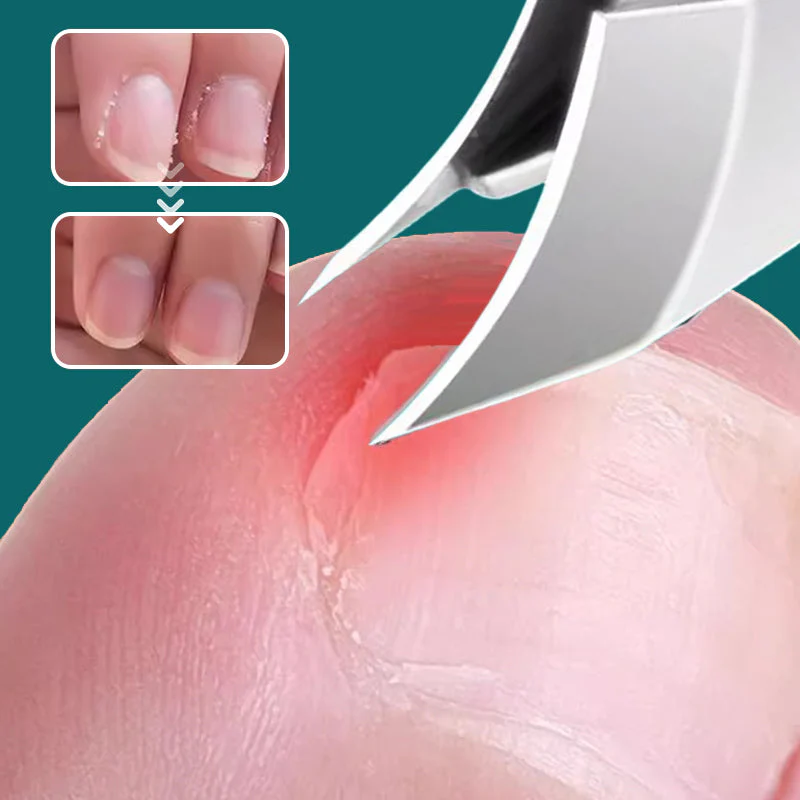 📢2025 Vente à chaud💅 Set de 3 pièces de coupe-ongles à bord incliné 25° anti-éclaboussures - Image 4