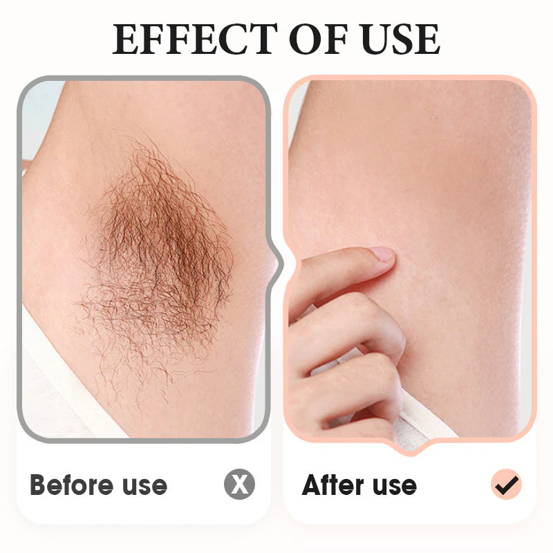 ⏳Spécial à durée limitée⏰Crème dépilatoire douce pour les aisselles, les jambes et les bras - Image 6