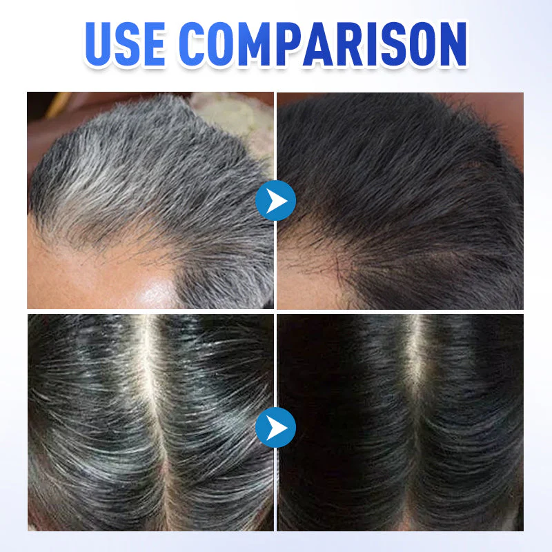 📢📢54 % DE RÉDUCTION !!! ✨Teinture douce instantanée pour cheveux gris - Image 3