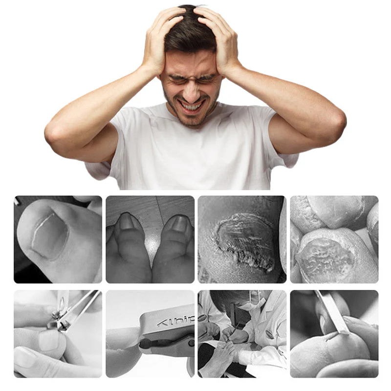 📢📢60 % DE RÉDUCTION !!⏰Coupe-ongles professionnels pour ongles incarnés 7 pièces - Image 2
