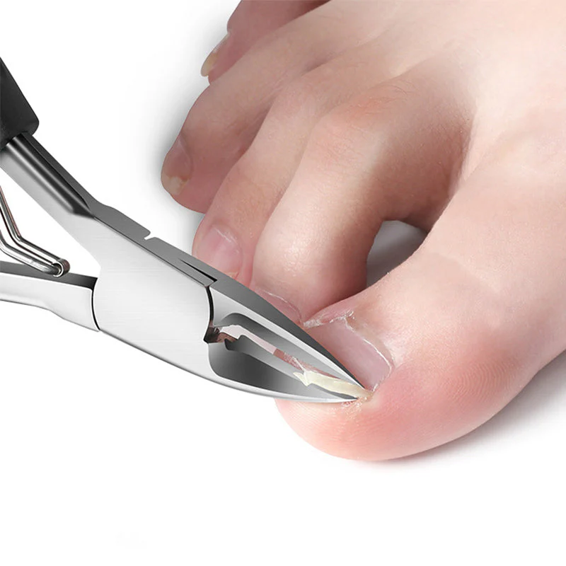 📢📢60 % DE RÉDUCTION !!⏰Coupe-ongles professionnels pour ongles incarnés 7 pièces - Image 7