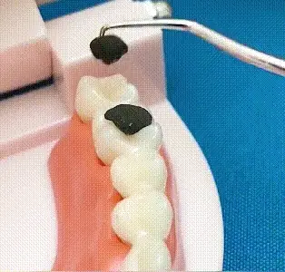 🏆Ingénierie de précision allemande ! Pointe ultra-fine de 0.1 mm pour un nettoyage précis entre les dents.✨ - Image 2