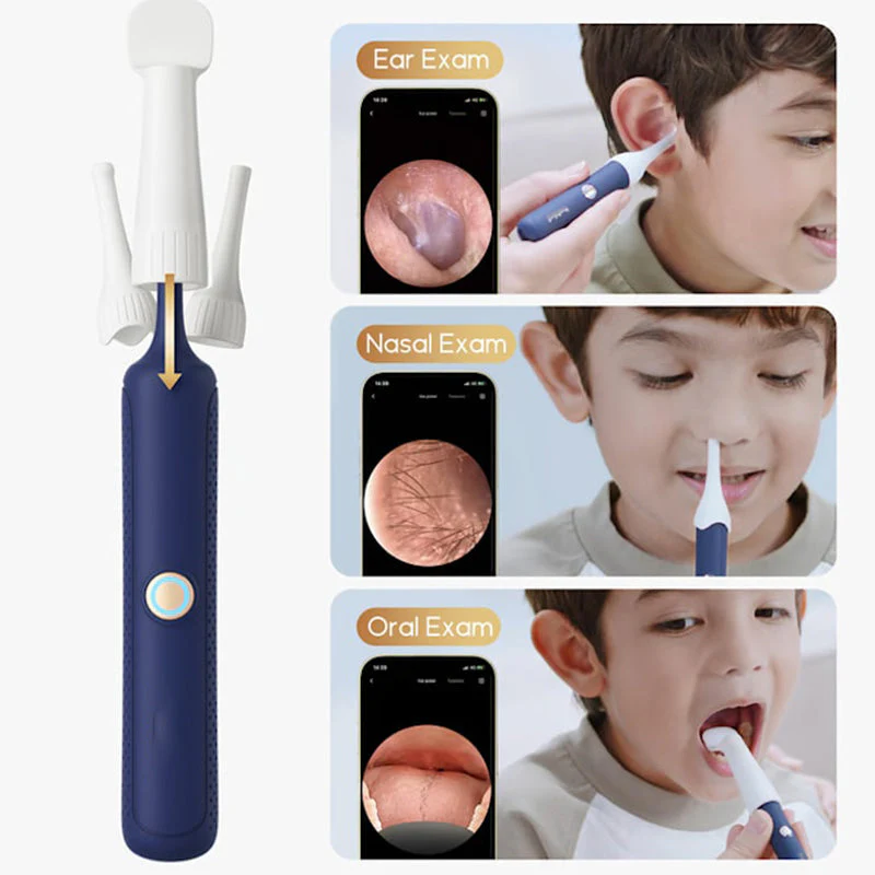 ⏳Time-limited Special⌛ Visual Curved Earwax Removal Kit - Image 4